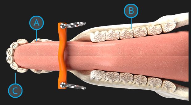  Horse bit in relation to dental anatomy of the horse
